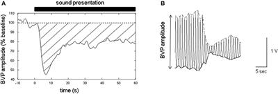 Correlation Between Resting Testosterone/Cortisol Ratio and Sound-Induced Vasoconstriction at Fingertip in Men